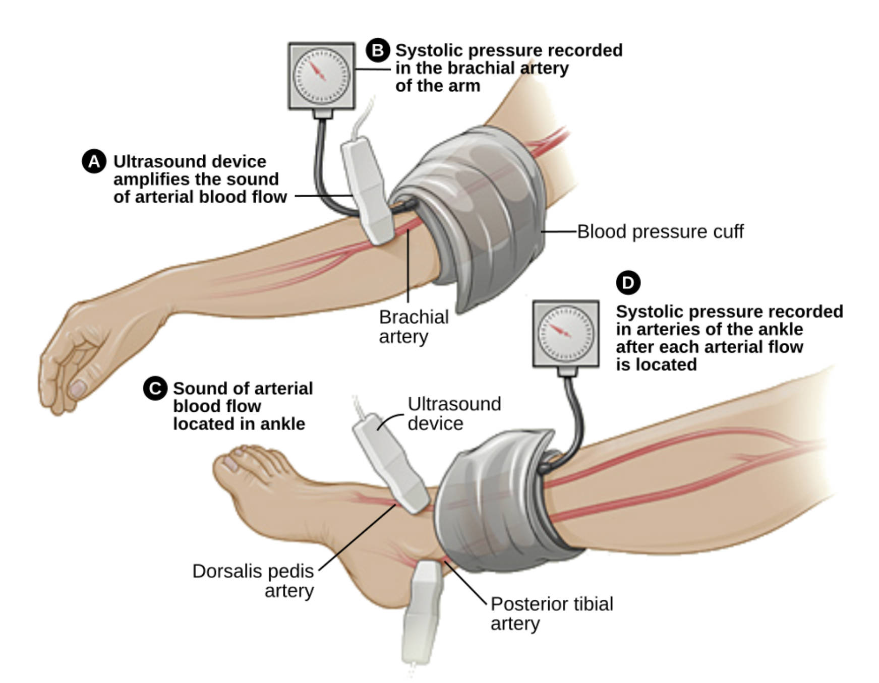 The Ankle-Brachial Index Test: Diagnosing Peripheral Artery Disease and Vascular Health